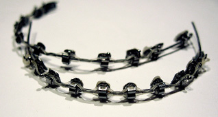 Nitinol dental braces-XOT metals-2